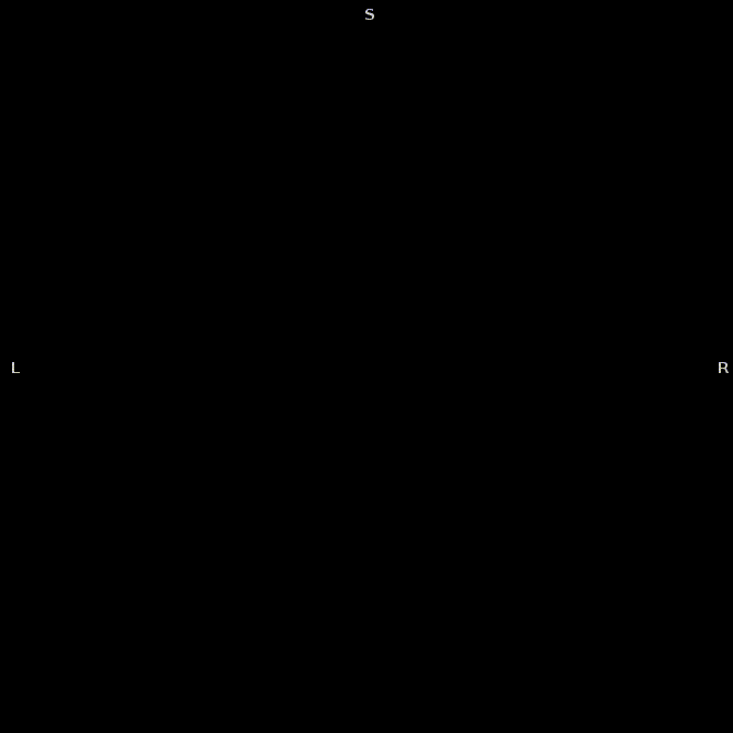cb