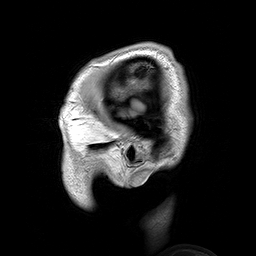 Human Brain
